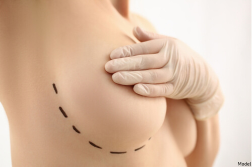 5 Tips To Lift Your Breasts Without Surgery