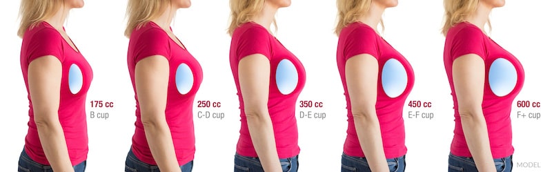 The Perfect Breast Implants Size